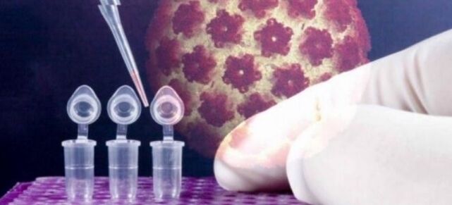 HPV-ի ախտորոշում դիգենի թեստի միջոցով